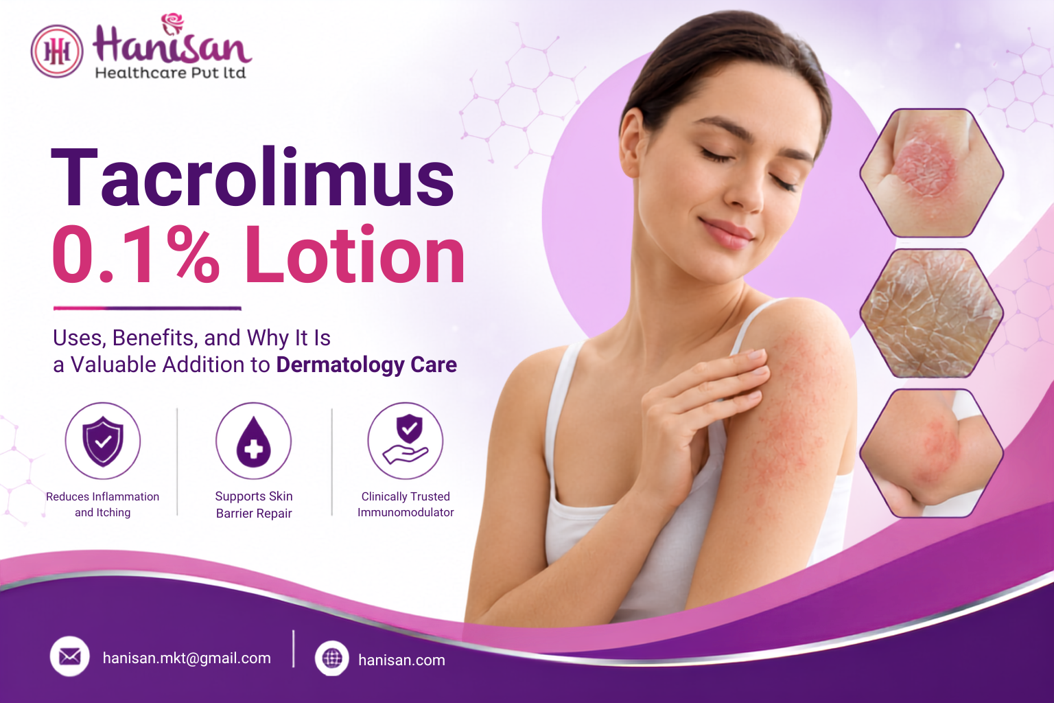 Tacrolimus 0.1% Lotion Tacrolimus 0.1% Lotion